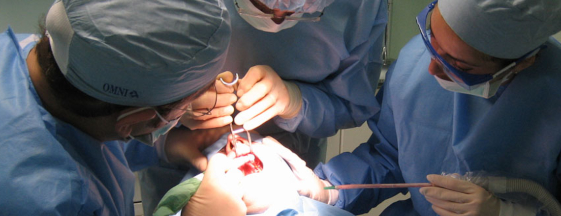 Chirurgia orale cisti